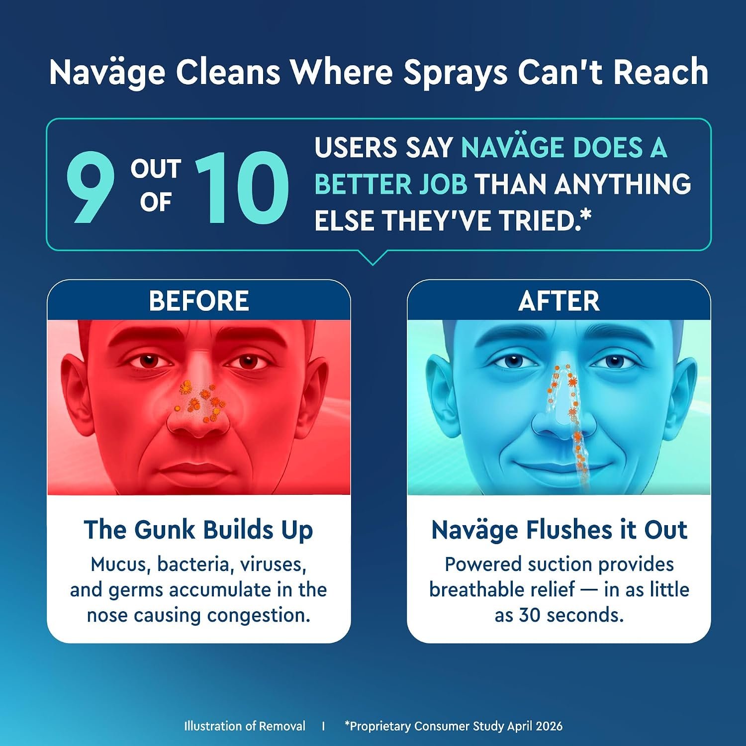 NAVAGE® Starter Bundle: Nose Cleaner, 30 SaltPods, Congestion Relief | Complete Sinus Care Kit: Powered Nasal Irrigation System w/ 30 Pre-Measured SaltPods for Clinically Proven Benefits - Image 3
