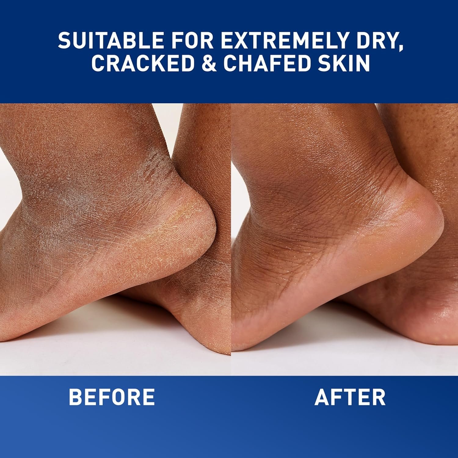 CeraVe Healing Ointment, Hyaluronic Acid Skin Protectant for Dry Skin, 3oz | Skin Care, Body Care, Barrier Cream, Skin Barrier Repair, Ceramides, Petrolatum, Lanolin Free, For Cracked, Chafed Skin - Image 5