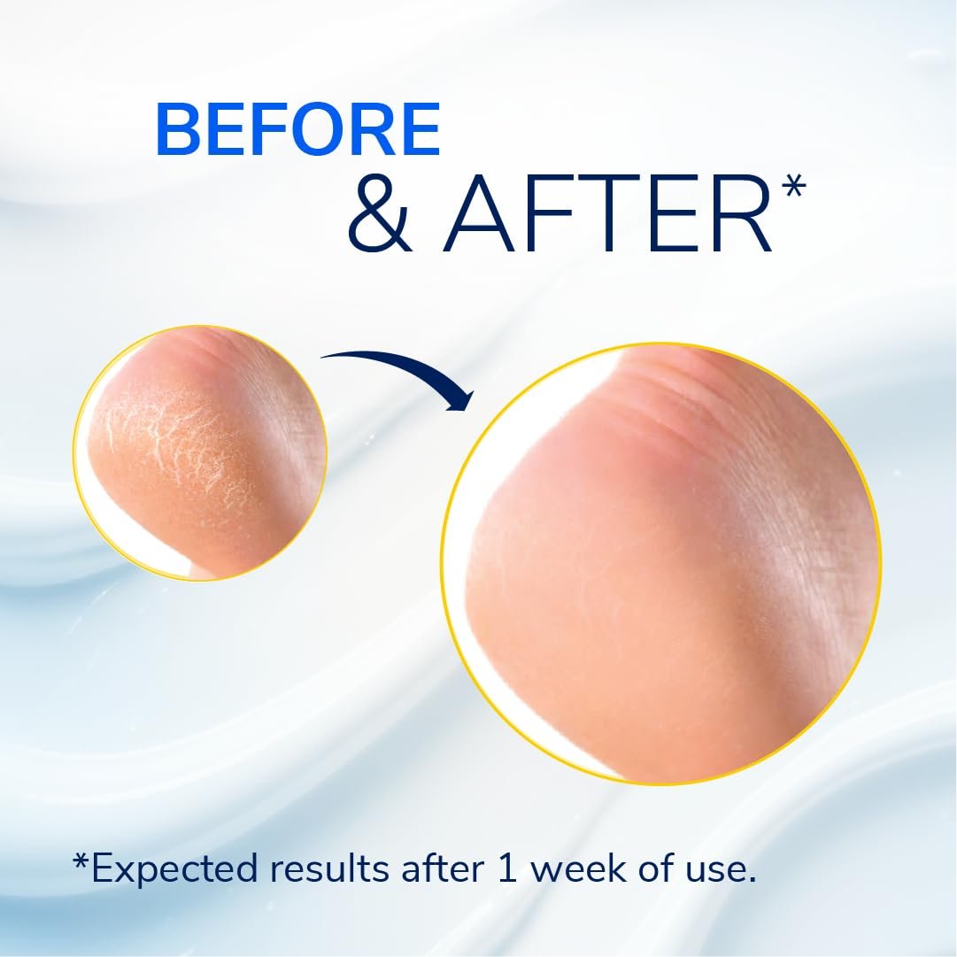 Dr. Scholl's Severe Cracked Heel Repair Restoring Balm 2.5oz, with 25% Urea for Dry, Cracked Feet, Heals and Moisturizes for Healthy Feet - Image 3