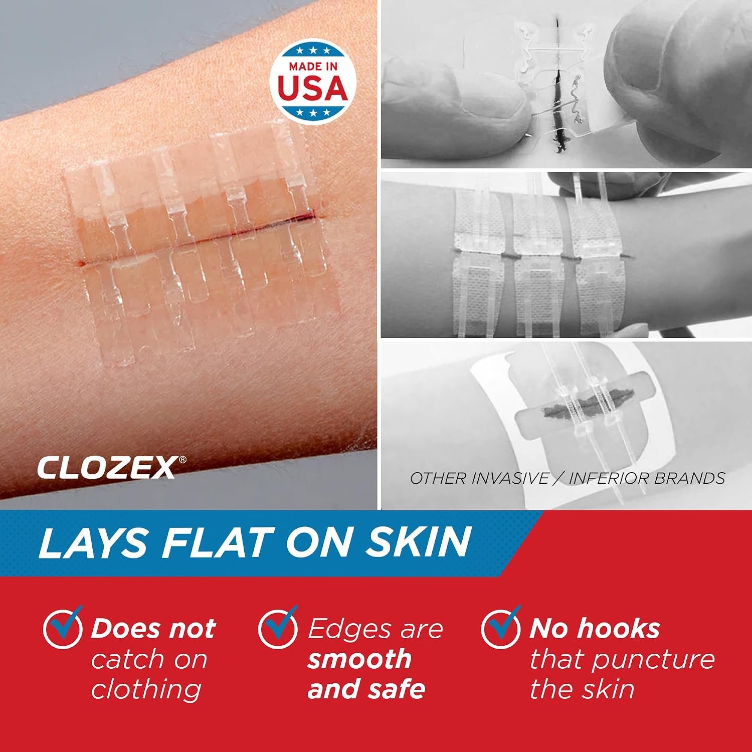 Clozex Emergency Laceration Kit - Repair Wounds Without Stitches, Skin Closure Device for a Wound Up to 1 1/2 Inches Length. Complete Kit to Clean, Close, & Cover Wounds - Image 4