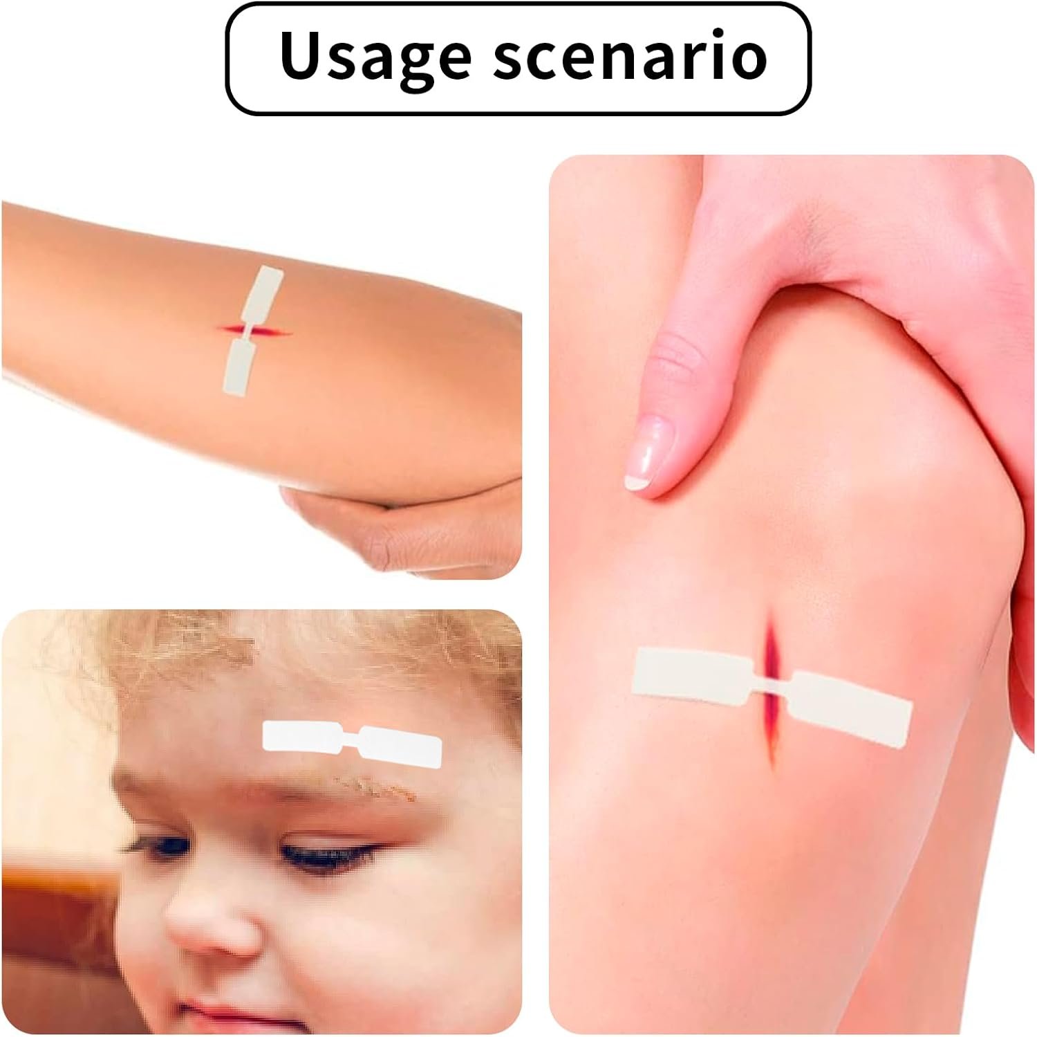 120PCs Waterproof Butterfly Adhesive Closure Strips Wound Bandages - Image 7