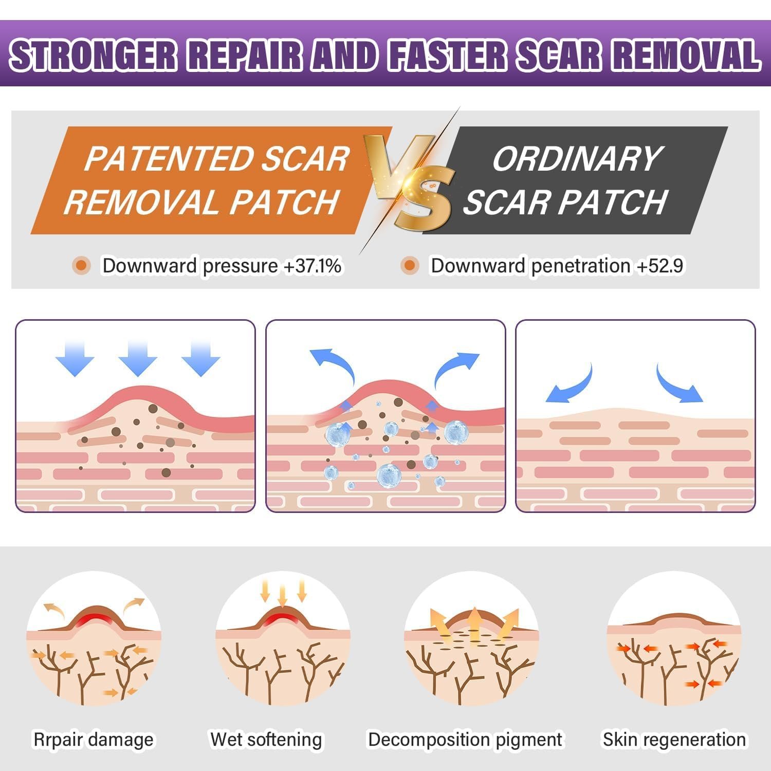 Silicone Scar Sheets, Medical Grade Silicone Scar Tape for Old & New Scars - Image 3
