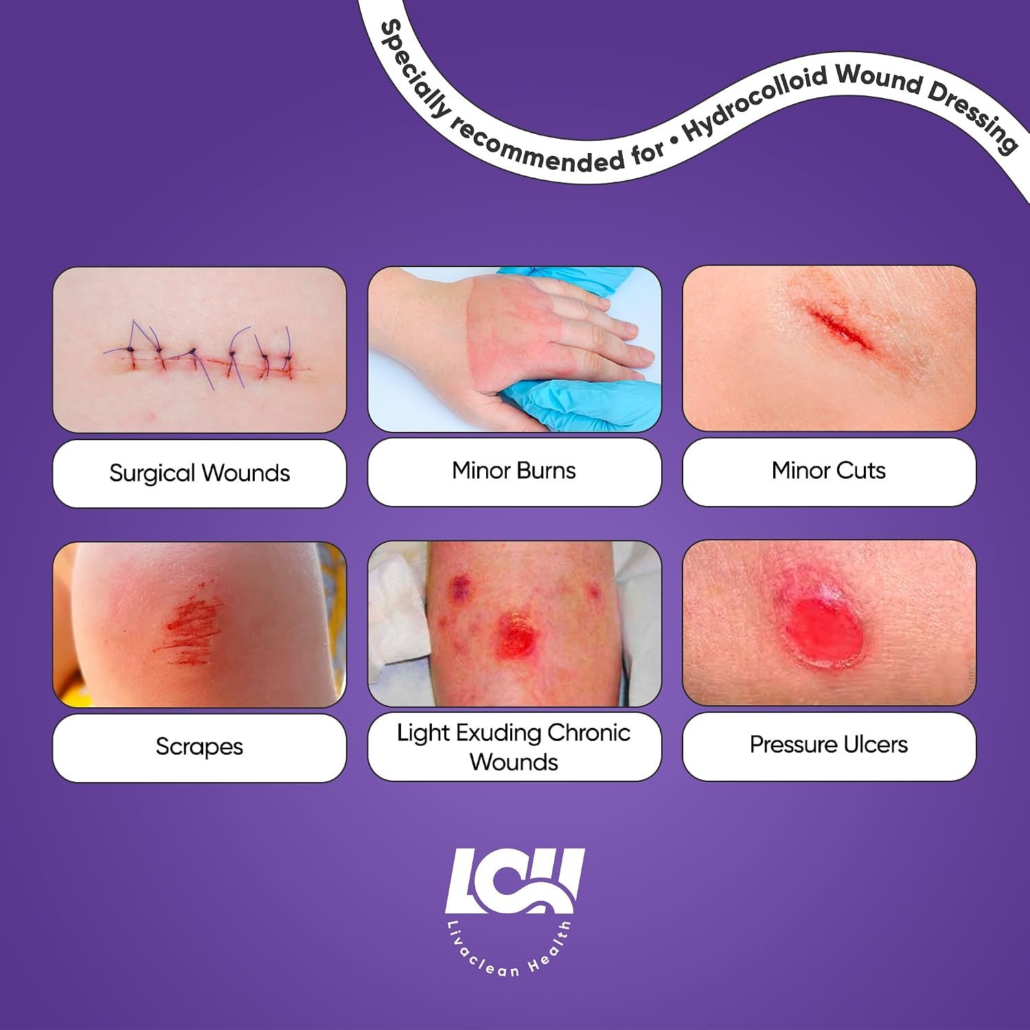 15 CT 2" x 2" Hydrocolloid Wound Dressing - Sterile Colloidal Bandages - Adhesive Hydrocolloid Bandages Small - Individually Packed Healing Patches for Wounds and Blisters by Livaclean Health - Image 7