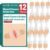 AZEN 12 Pack Emergency Wound Closure Strips, Butterfly Bandages, Laceration Closure Zip Stitch, Repair Wounds Without Stitches